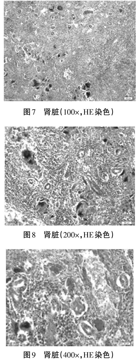 鸭胚大肠杆菌和肺炎克雷伯菌的分离鉴定与药敏分析