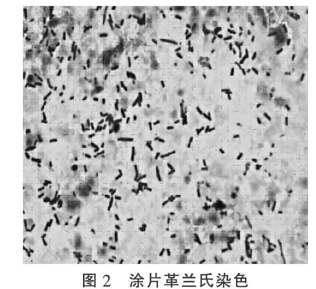 一例鸡球虫病和魏氏梭菌病混合感染的诊治